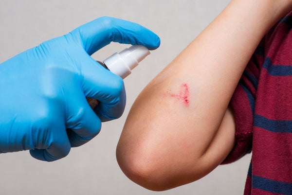 Nurse spraying solution to cleanse patient's scrape on arm